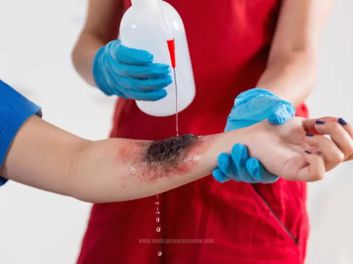 Burn Injury Lawsuits: Proving Negligence and Securing Compensation