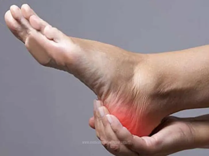 Case study on nursing home negligence leading to severe pressure ulcers in a dementia patient